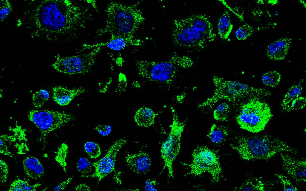 AEMPS authorizes AP-2 clinical trial for ALS treatment led by Molefy Pharma