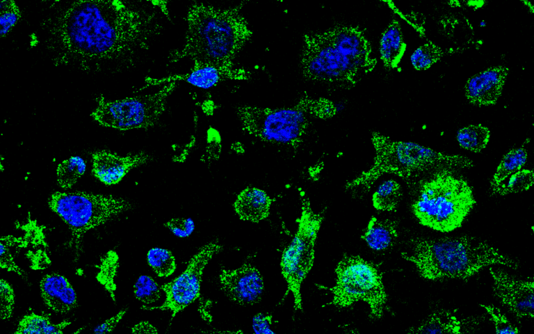 AEMPS authorizes AP-2 clinical trial for ALS treatment led by Molefy Pharma